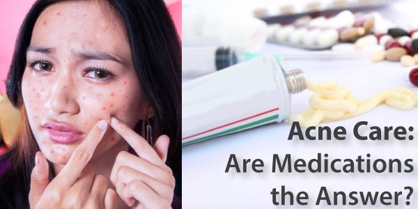 Acne Care: Are Medications the Answer?