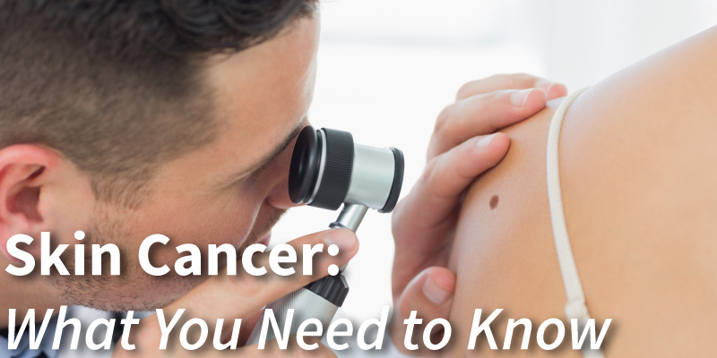 all about skin cancer