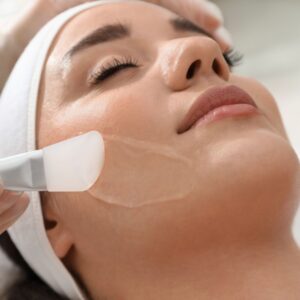 Chemical peel