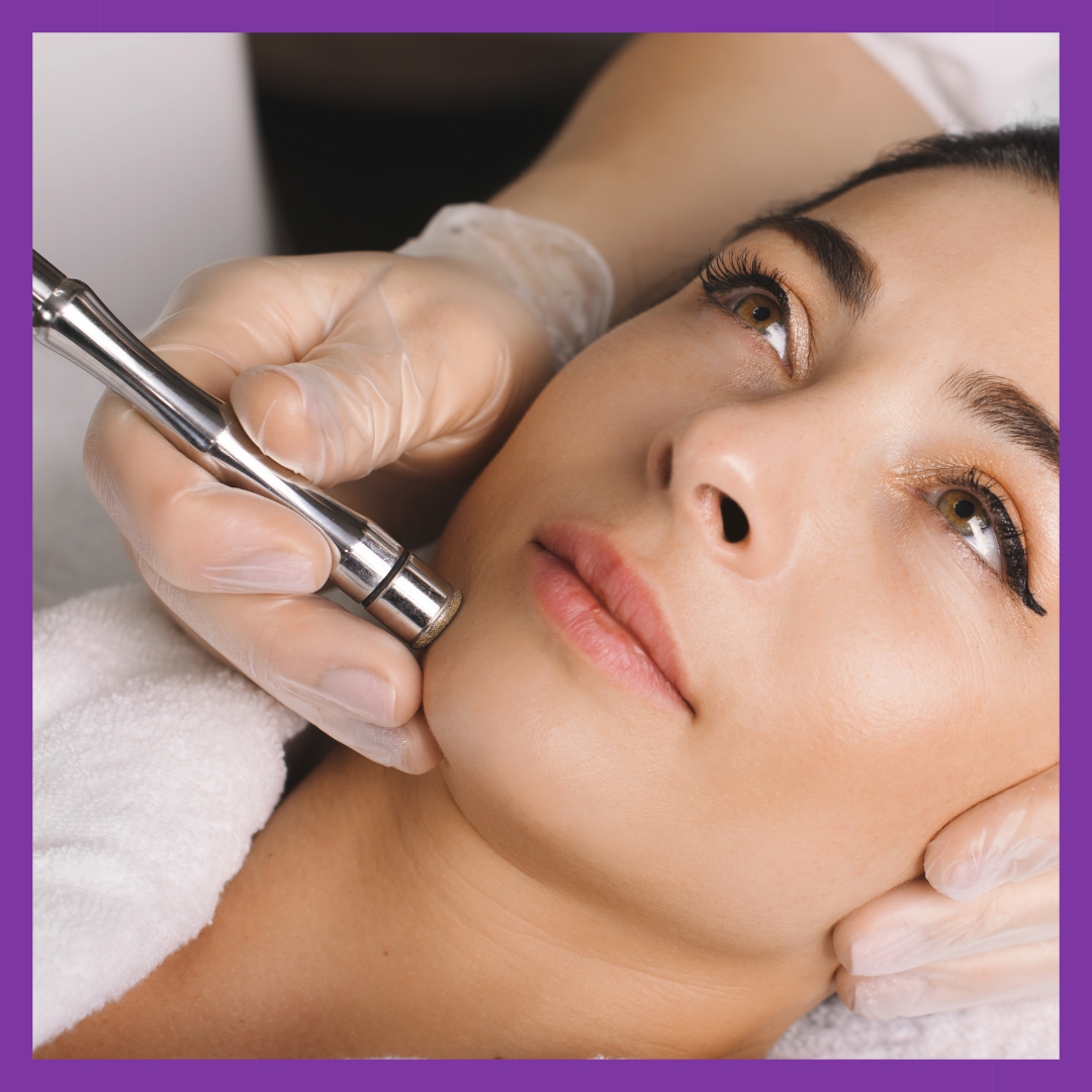 image of microdermabrasion